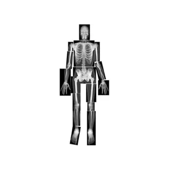 True To Life Human X Rays - 18 Pieces - Modern Teaching Aids NZ