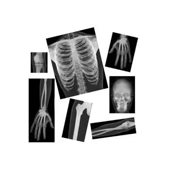 True To Life Human X Rays - 18 Pieces - Modern Teaching Aids NZ