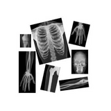 True To Life Human X Rays - 18 Pieces - Modern Teaching Aids NZ
