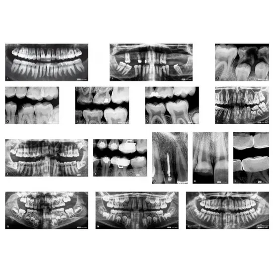 Dental X-Rays - Modern Teaching Aids NZ