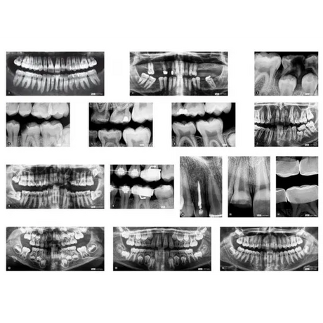 Dental X-Rays - Modern Teaching Aids NZ