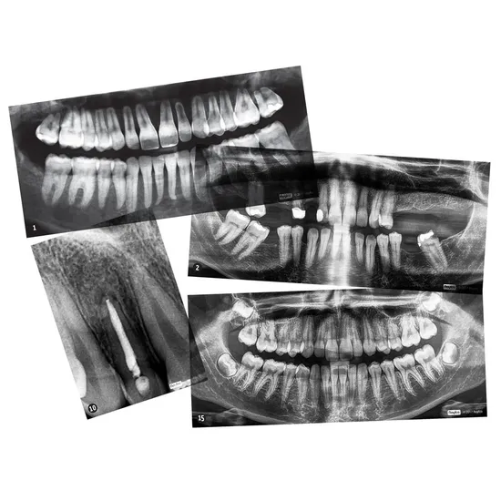 Dental X-Rays - Modern Teaching Aids NZ