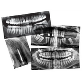 Dental X-Rays - Modern Teaching Aids NZ