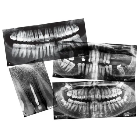 Dental X-Rays - Modern Teaching Aids NZ