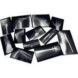Fixed Bones X-Rays - Set of 14 Cards - Modern Teaching Aids NZ