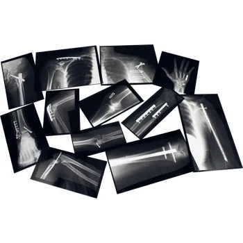 Fixed Bones X-Rays - Set of 14 Cards - Modern Teaching Aids NZ