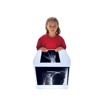 Fixed Bones X-Rays - Set of 14 Cards - Modern Teaching Aids NZ